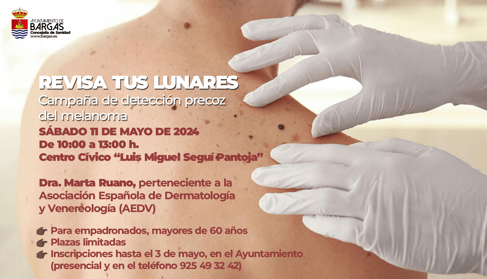 Revisa tus lunares. Campaña de detección precoz del melanoma.